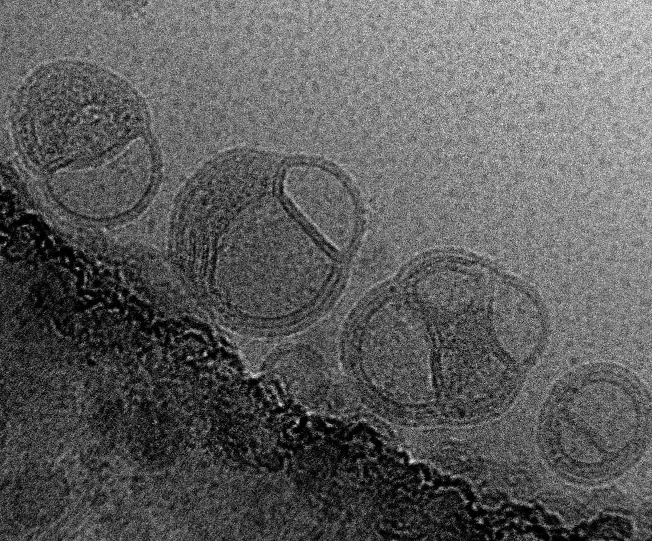 Cryo-TEM of a lipid nanoparticle co-encapsulating mRNA and a small-molecule chemotherapeutic